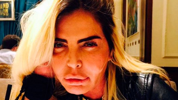 Raquel Mancini salió del coma inducido: Estuve a punto de morirme