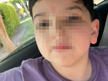 Parte médico: confirman que Bastian tiene lesiones cerebrales y cervicales severas