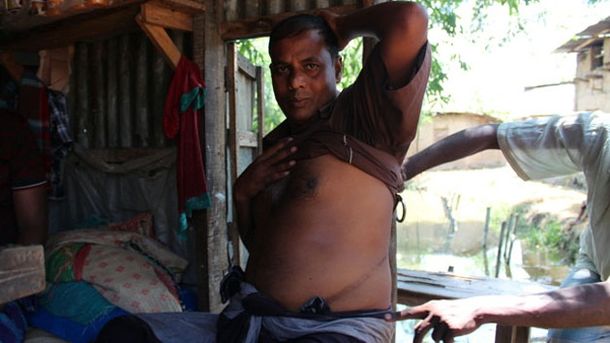 En Bangladesh venden órganos para poder pagar deudas