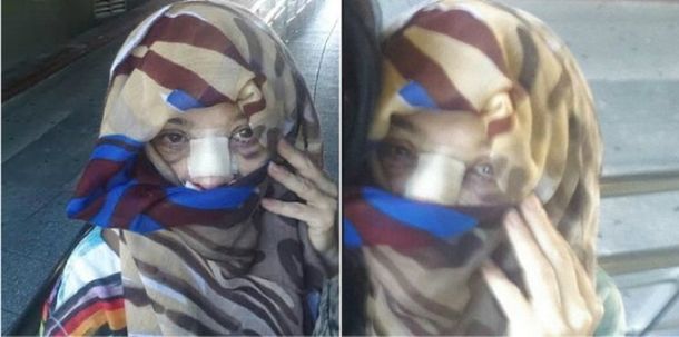 Irreconocible: ¿quién es esta mediática recién operada?