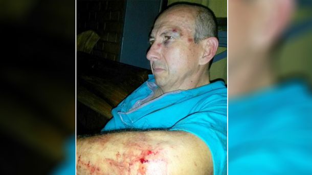Le tocó bocina a un motociclista y recibió una brutal paliza