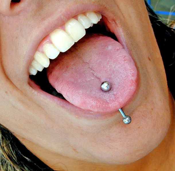 Advierten que los piercings en la boca generan problemas al hablar