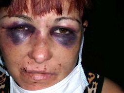 Mariela González tiene 40 años y fue atacada por su pareja