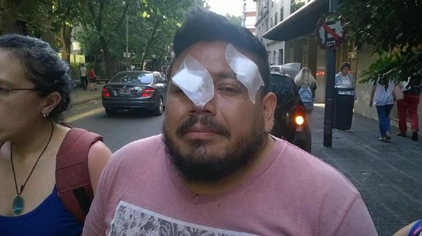Daniel Sandoval perdió un ojo en una protesta contra la reforma previsional - Crédito: @valeriafgl