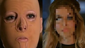 la increible transformacion de la mujer a la que le quemaron 60% del cuerpo la increible transformacion de la mujer a la que le quemaron 60% del cuerpo