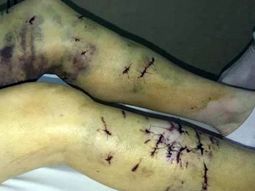 Una jauría atacó a una mujer en Ushuaia - Crédito: TN&nbsp;