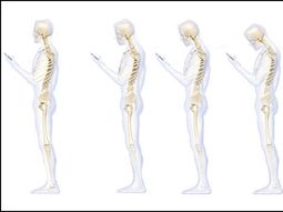 como afecta a la columna el uso prolongado del celular como afecta a la columna el uso prolongado del celular