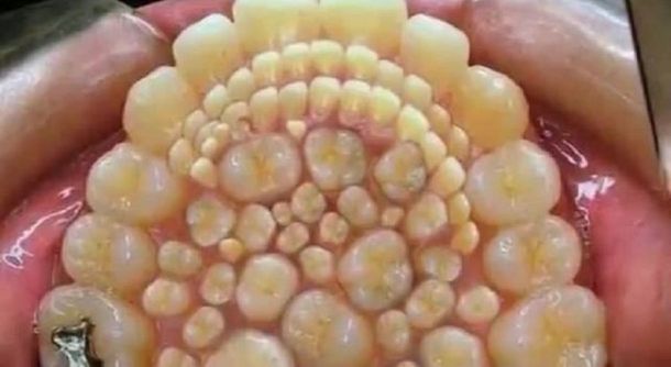 Le sacaron 232 dientes - Crédito: Diario Uno