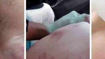 Las heridas que subrió el bebé Las heridas que subrió el bebé