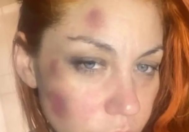 La denuncia por violencia de género que había realizado Lourdes de Bandana a Leandro García Gómez en 2022