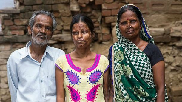 El hombre las roció con ácido a las dos mientras dormían