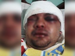 Lo acuchillaron en manada para robarle