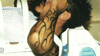 Operación de Fort Operación de Fort