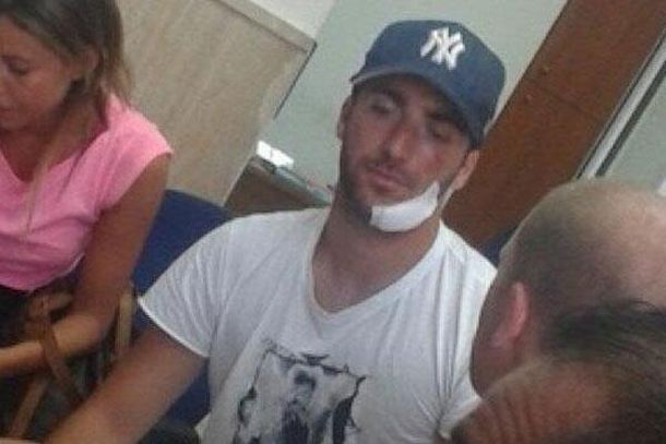 Así quedó Gonzalo Higuaín tras un insólito accidente