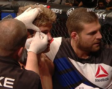 Los lindos también caen: el sex symbol de la UFC perdió su invicto