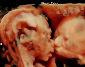 Isabella y Callie en la imagen más tierna