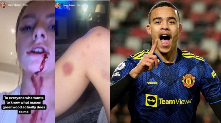 Detuvieron a un jugador del Manchester United tras una fuerte denuncia por violencia de género