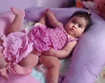 Avanza la operación de las siamesas Luciana y Bianca en el Posadas