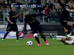 el tremendo pisoton que sufrio gonzalo higuain ante monaco el tremendo pisoton que sufrio gonzalo higuain ante monaco