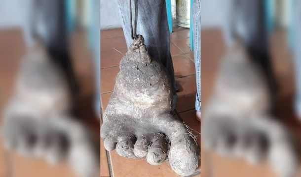 Los Ciquinel todavía no saben qué originó la forma de esta papa