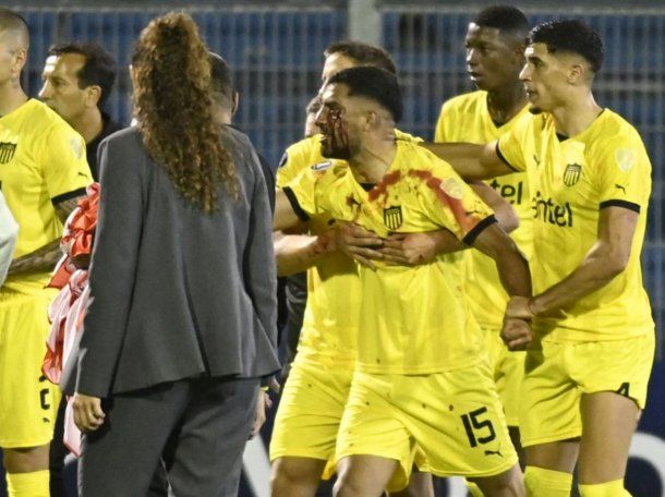 La sanción que podría recibir Rosario Central tras la agresión a un jugador de Peñarol