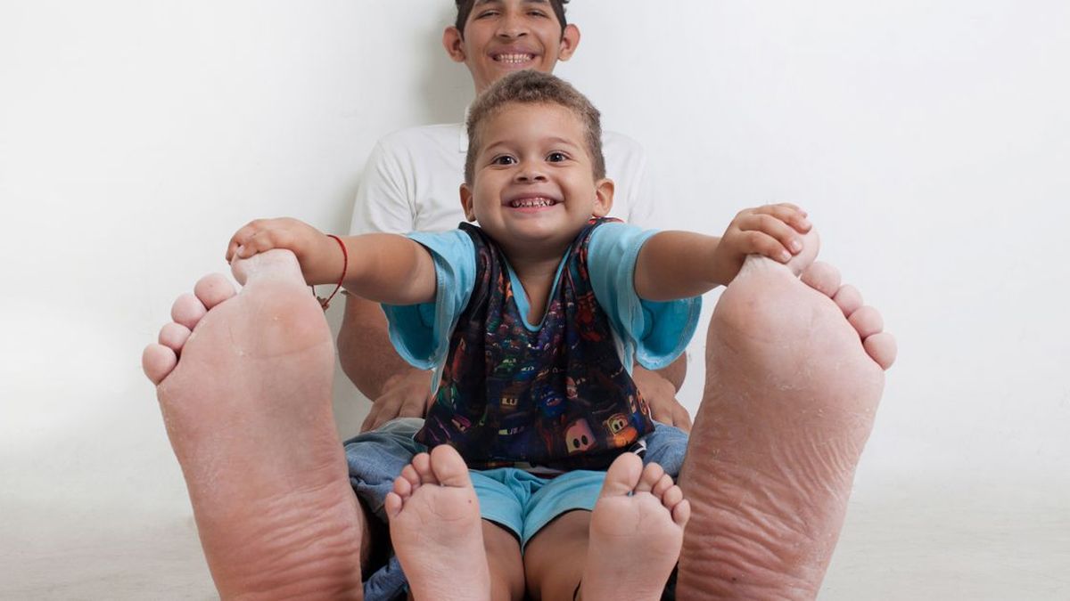 Calza 60 y se trata de la persona con los pies más grandes del mundo