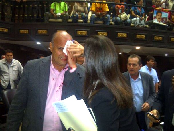 Sesión caliente en el congreso termina con un diputado herido