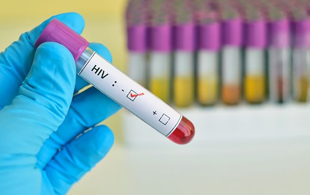 Avanza la cura del VIH con trasplantes de células madre