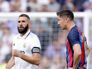 Karim Benzema superó golpe en la tibia y jugará ante Barcelona