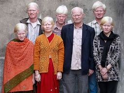Albino clan