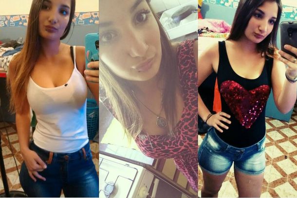 Joven que quemada por su pareja