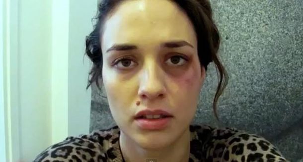 Lanzan impactante campaña contra la violencia de género