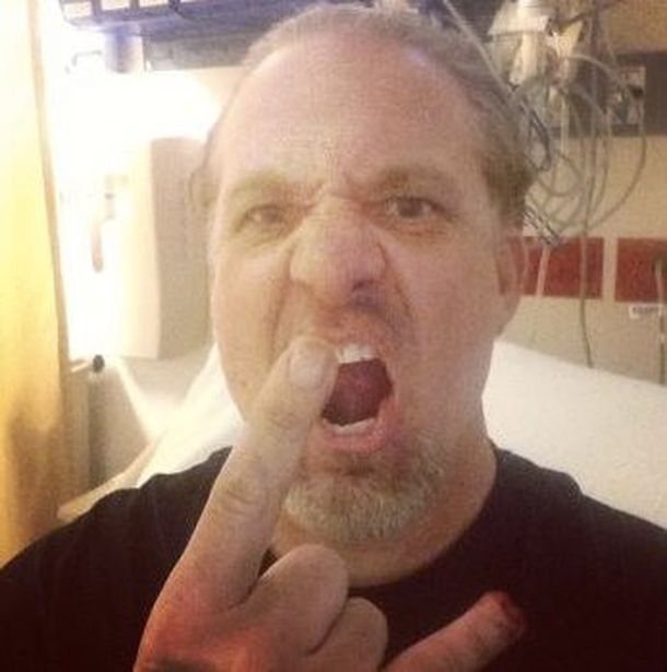 El ex marido de Sandra Bullock perdió un dedo y lo mostró en las redes sociales