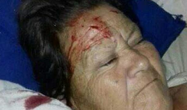 Santiago del Estero: a una mujer que estaba internada en un hospital le cayó un ventilador de techo en la cara