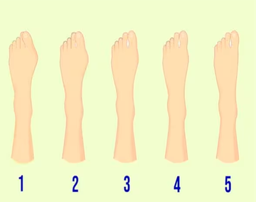 Test viral: la forma de tus pies revelará cómo sos en el amor