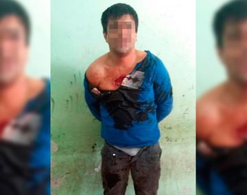 El hombre fue derivado al hospital local con varias mordeduras