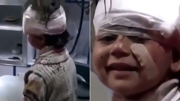 La sonrisa de la nena herida en Alepo