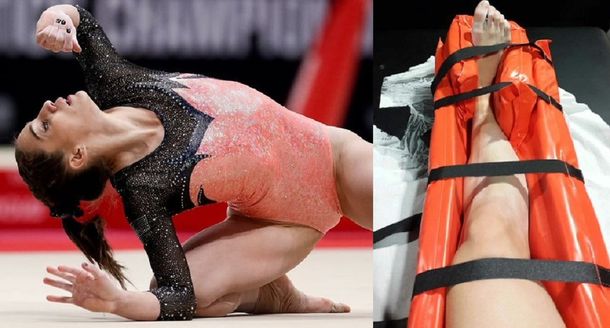 La escalofriante lesión de una atleta argentina