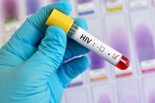 Por recortes en Salud, más de 15 mil personas con VIH están sin medicación