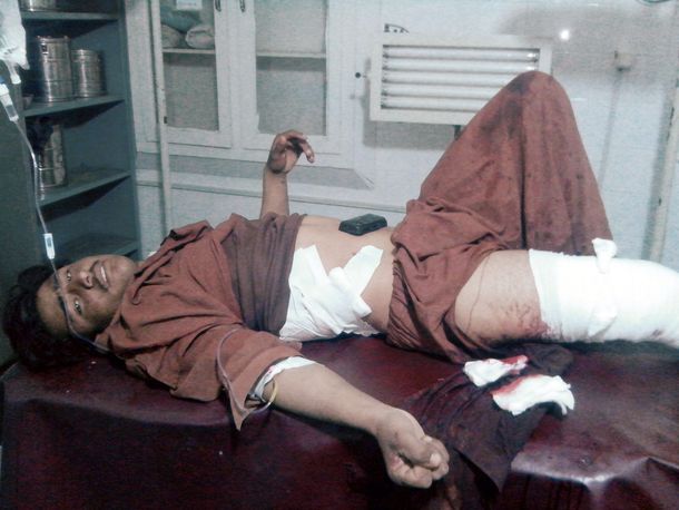 Uno de los heridos por el ataque suicida en Paktika