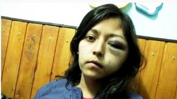 Mariana Arabena fue atacada por Alejandro Patricio Santarrosa Mariana Arabena fue atacada por Alejandro Patricio Santarrosa