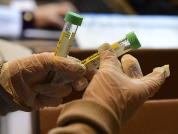 Rusia confirma que el primer lote de la vacuna contra el coronavirus será producido en 2 semanas