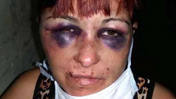 Mariela González tiene 40 años y fue atacada por su pareja