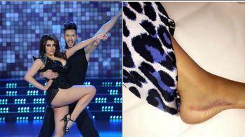 el insolito accidente de charlotte caniggia: rodo por las escaleras y se esguinzo un tobillo el insolito accidente de charlotte caniggia: rodo por las escaleras y se esguinzo un tobillo