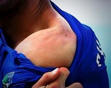 El jugador italiano agredido bancó a Luis Suárez: Fue excesiva la sanción