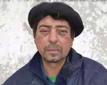 Les pidió a los policías que dejen sus celulares y recibió una brutal golpiza