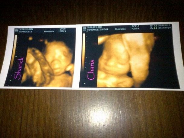 Cinthia Fernández y Matías Defederico compartieron la ecografía 4D de sus gemelas