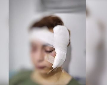 Santa Cruz: un joven denuci&oacute; a cuatro efectivos policiales de R&iacute;o Gallegos por brutalidad y detenci&oacute;n arbitraria