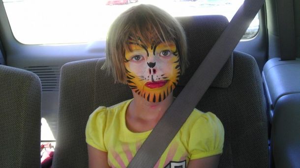 Un mapache le comió la nariz y le construyeron una nueva