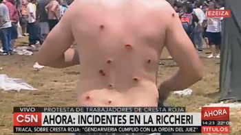 video: asi resulto herido un manifestante en la protesta de cresta roja video: asi resulto herido un manifestante en la protesta de cresta roja